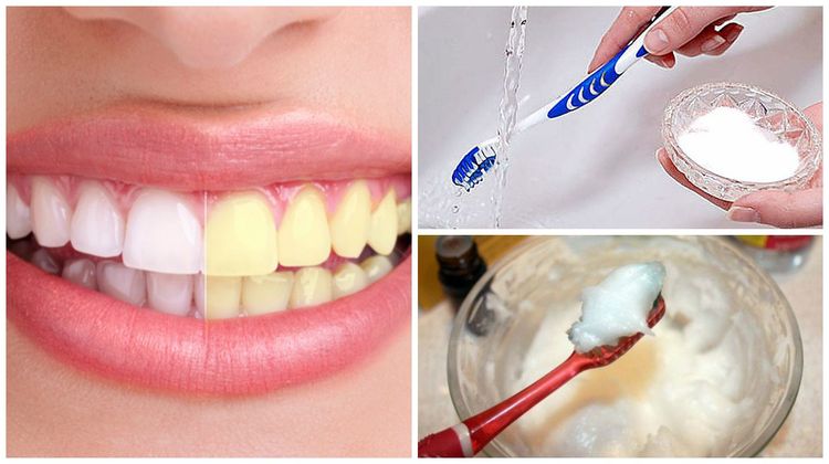 Resultado de imagen para Un amigo dentista me enseñó como eliminar el sarro y blanquear mis dientes en casa